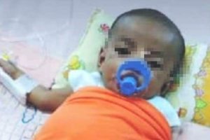 Mengidap Kista Hati, Bayi 3 Bulan di Karimun Sangat Butuh Uluran Tangan Donatur